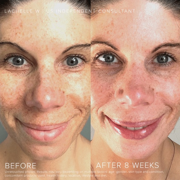 COPY - Rodan&Fields Reverse Regimen - Picture 4 of 4